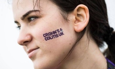 Woman with Crohn's & Colitis UK Tattoo